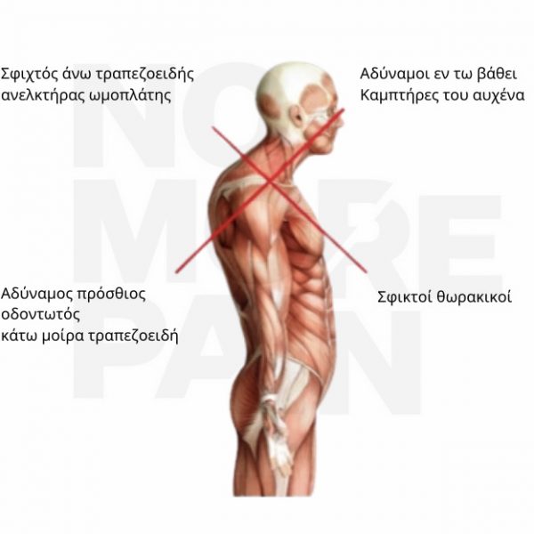 Poor postures negative effects