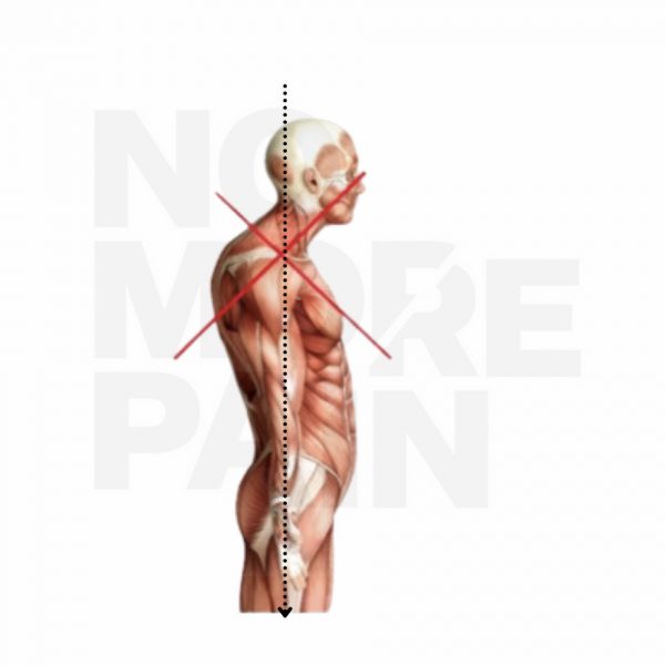 Poor posture